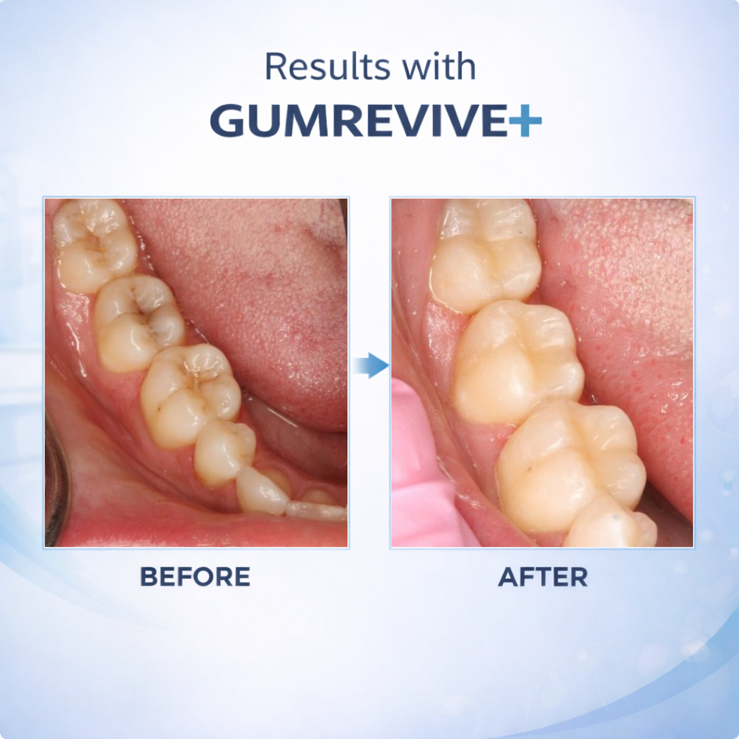 Dentira GUMREVIVE+ Ozonated Oil Pulling