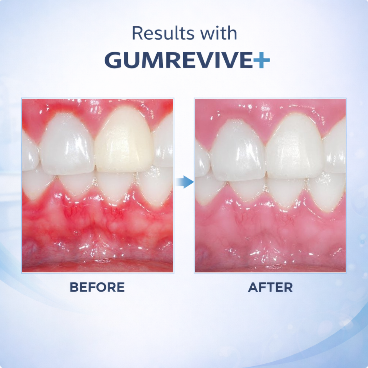 Dentira GUMREVIVE+ Ozonated Oil Pulling